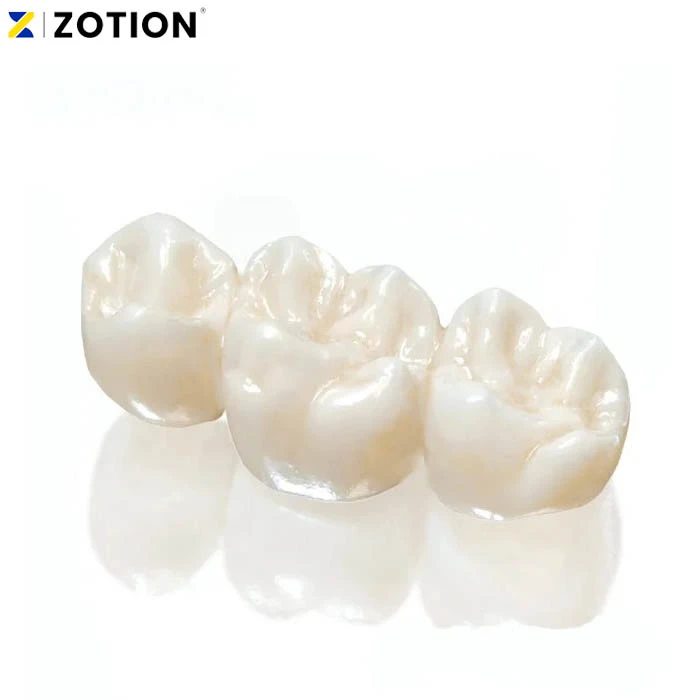 Porcelain vs. Zirconium Dental Crowns – Which is Better?